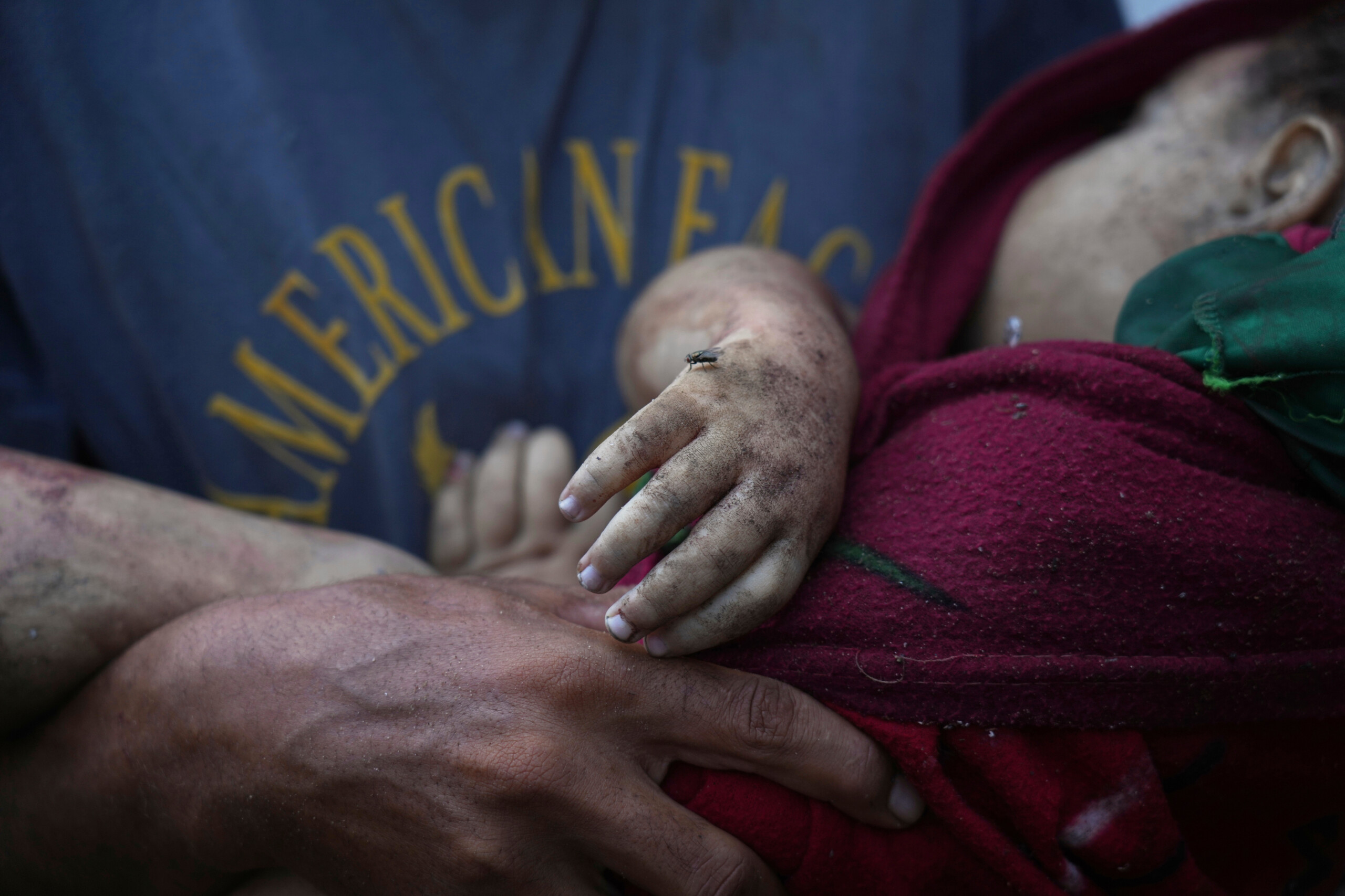 middle east gaza 8 deaths from starvation in 24 hours including 2 children 281 since the start of the war scaled