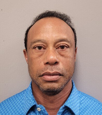 tiger woods released on bail after arrest following a road accident
